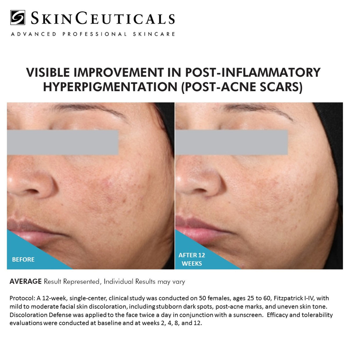Discoloration Defense SkinCeuticals Body Clinic Skincare