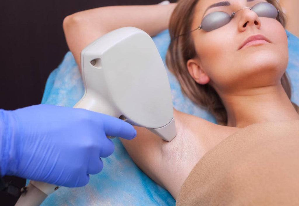 Common Questions about Laser Hair Removal